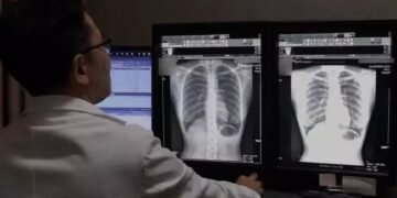 भारत में आ रहा ऐसा AI सिस्टम, जो X-Ray देखकर बता देगा बीमारी