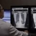 भारत में आ रहा ऐसा AI सिस्टम, जो X-Ray देखकर बता देगा बीमारी