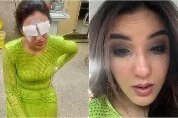 कॉर्निया डैमेज के बाद पहली बार एयरपोर्ट पर नजर आई जैस्मिन भसीन