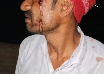 फ्यूज जोड़ने से मना किया तो संविदा कर्मी लाइन मैन की पिटाई
