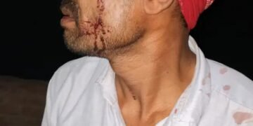 फ्यूज जोड़ने से मना किया तो संविदा कर्मी लाइन मैन की पिटाई